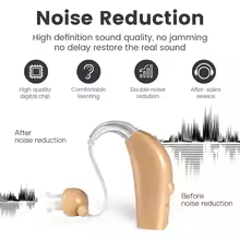 Portable Rechargeable Hearing Aid Sound Amplifier Magnetic Rechargeable Elderly Ear Hearing Aid For The Deaf - Image 3